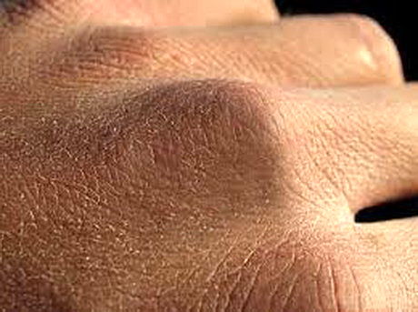 راه‌های مقابله با خشکی پوست دست در روزهای کرونایی